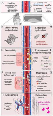 Multi-Scale Imaging of Vascular Pathologies in Cardiovascular Disease